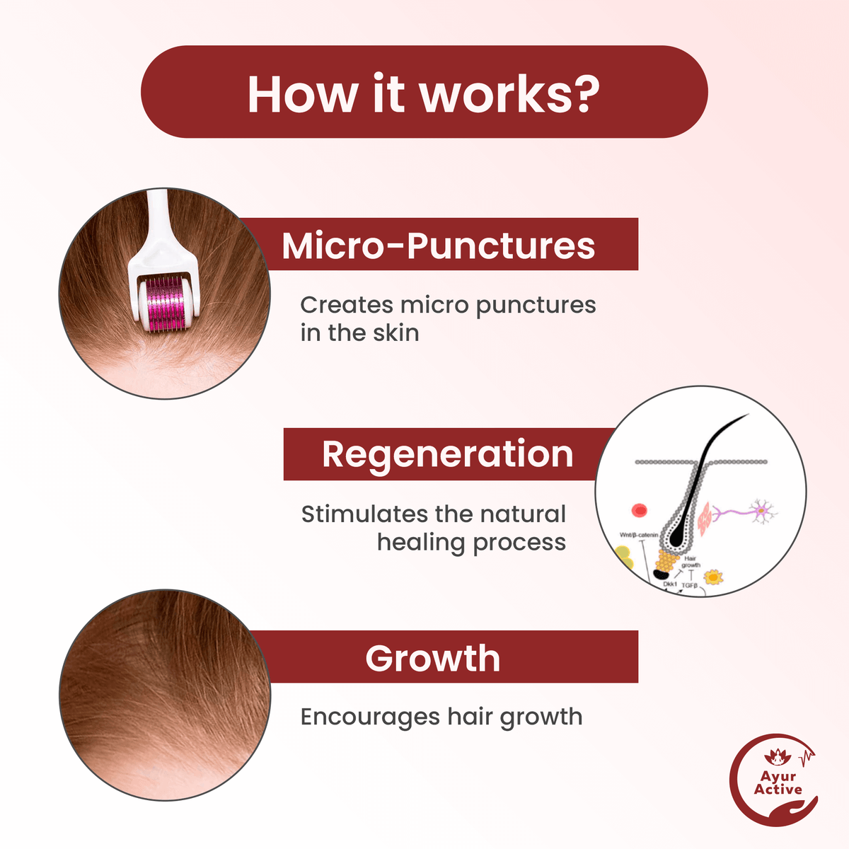 Derma Roller